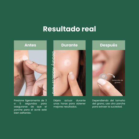 Parches transparentes para absorber impurezas y reducir inflamación.