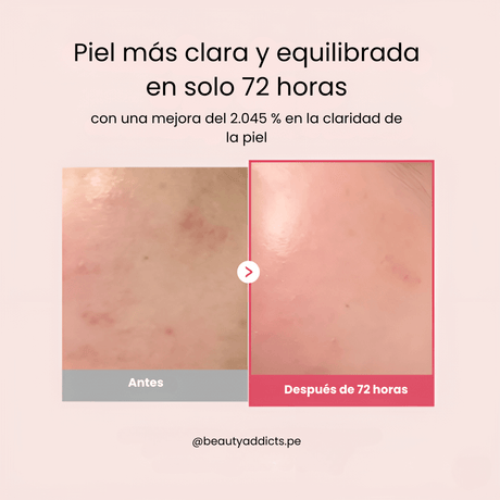 TXA Niacinamide 15 Serum que áctua como despigmentante para mejorar la uniformidad de la piel.
